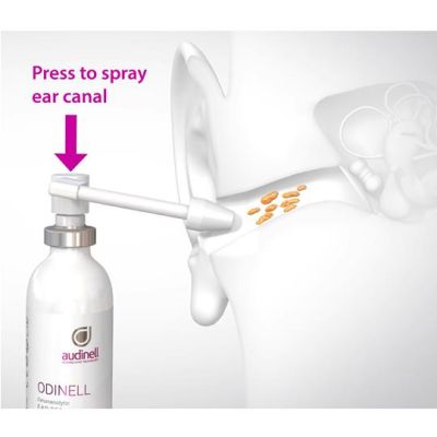 Audinell Odinell Earwax Removal Spray Replacement Nozzle Tips, Pack of 100