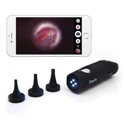 Firefly DE570 HD wireless digital video otoscope for IOS/Android.
